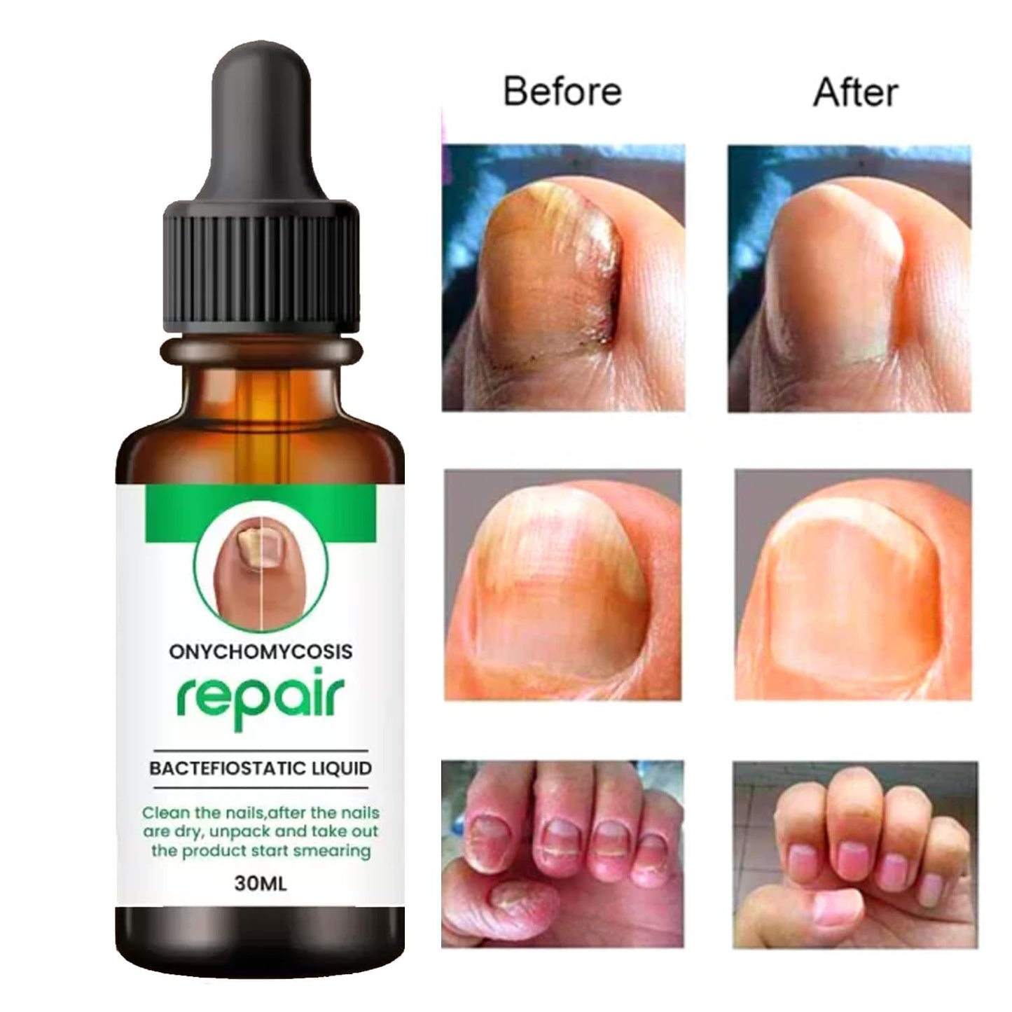 NailRevive™ Keratin Repair Elixir