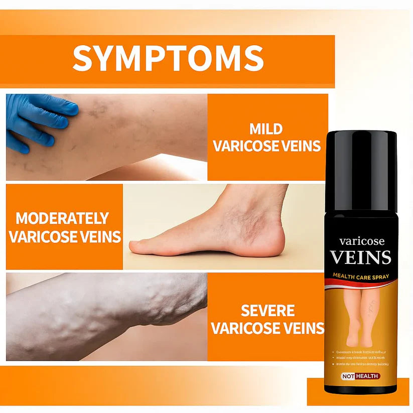 Turmeric Varicose Veins Relief Spray ( Buy 1 Get 1 Free )