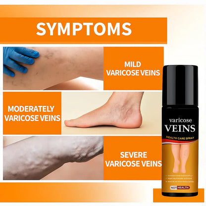 Turmeric Varicose Veins Relief Spray ( Buy 1 Get 1 Free )