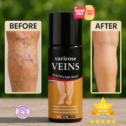 Turmeric Varicose Veins Relief Spray ( Buy 1 Get 1 Free )